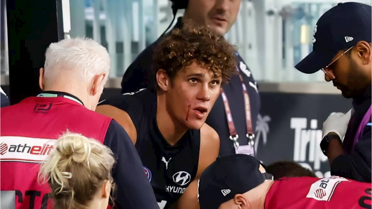 Carlton Star Charlie Curnow Undergoes Scans After Knee Injury