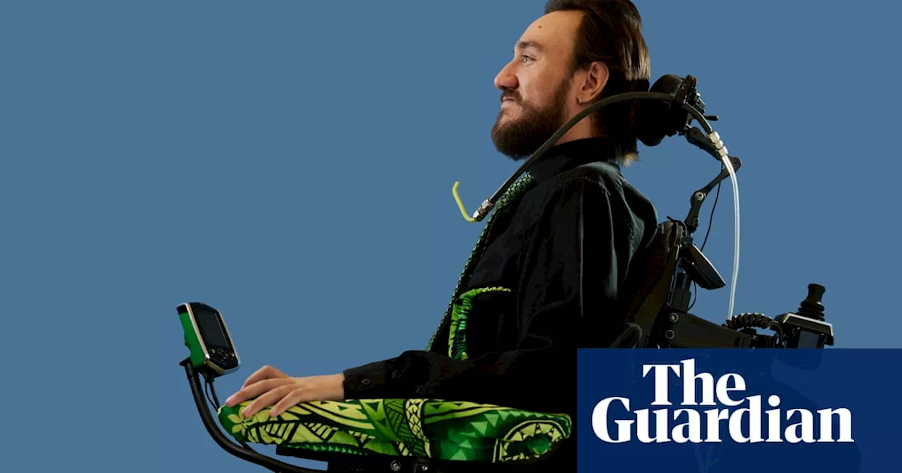 Elon Musk Implants Brain Chip in Paralyzed Man: Miracle or Dystopia?