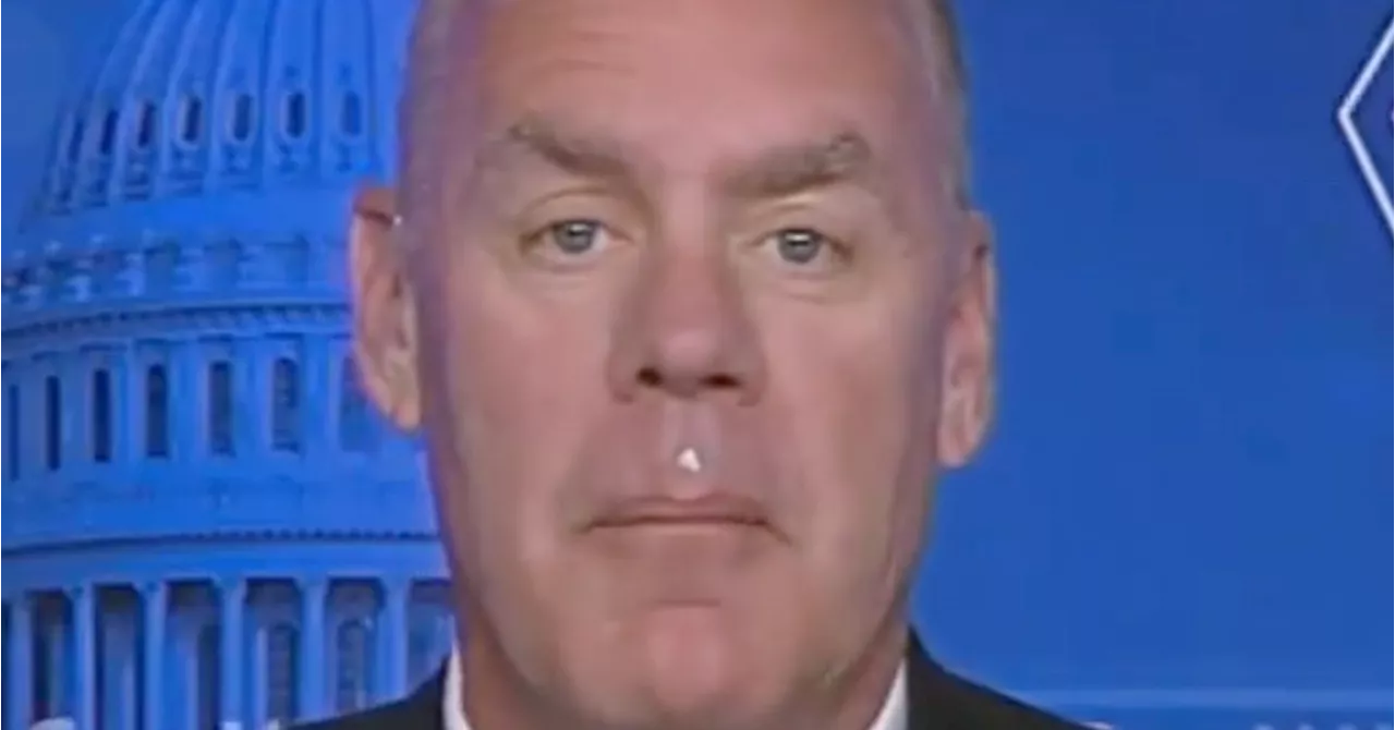 GOP Congressman Apparently Forgot To Clean Face Before Going On Fox News