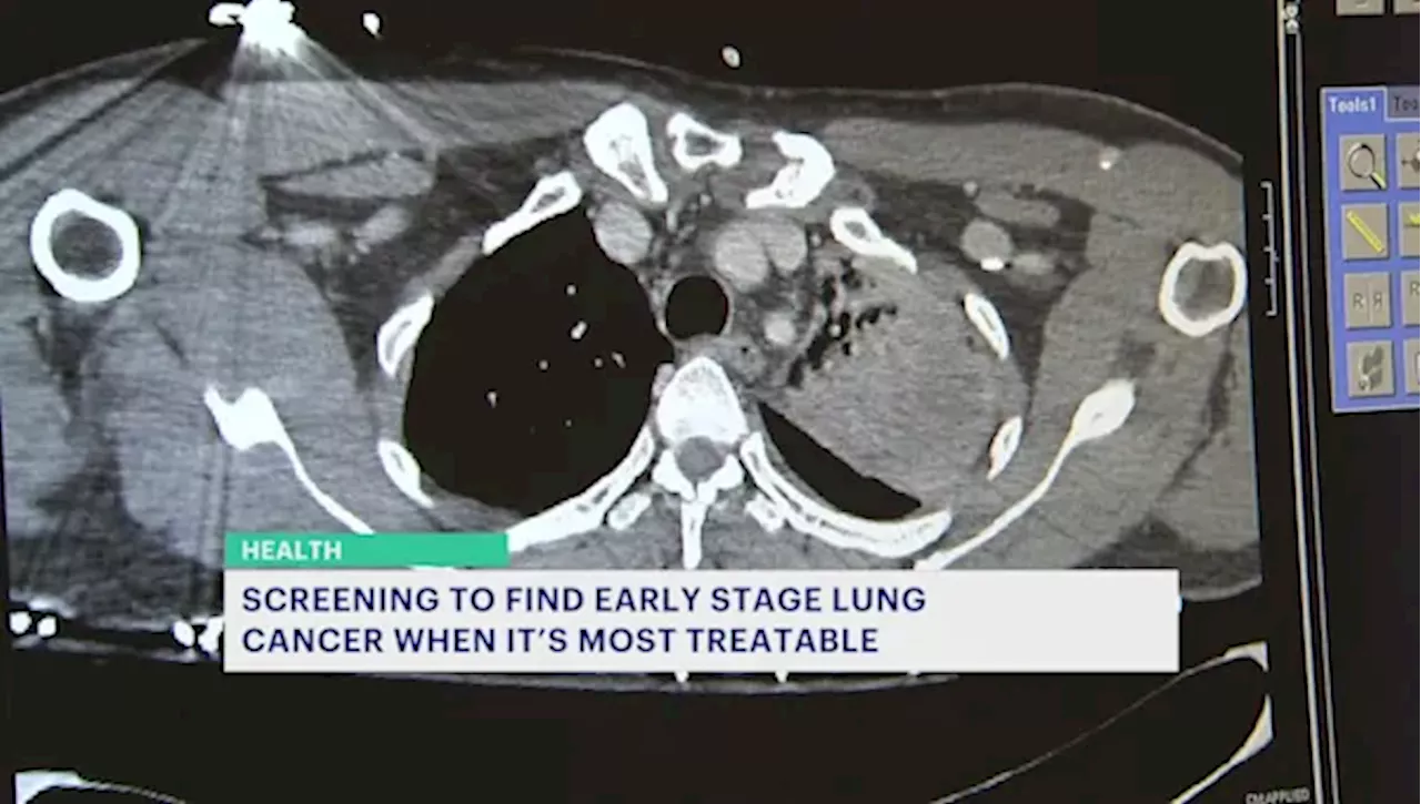 Lung Cancer Screenings Available but Underutilized