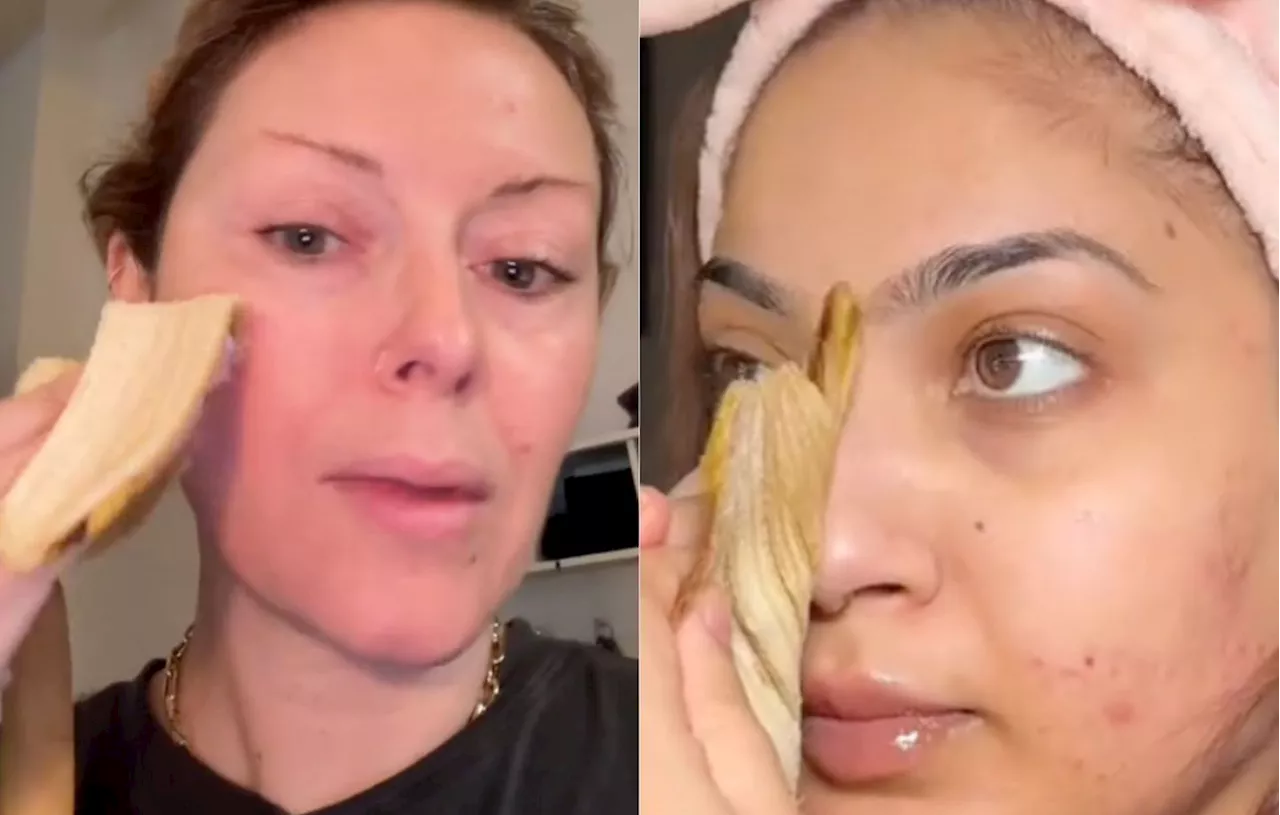 Banana Peel : La Dernier Tendance Beauty TikTok ?