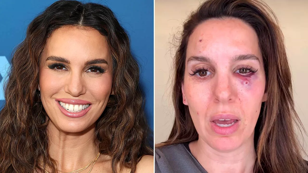 Disney Star Christy Carlson Romano Nearly Loses Eye in Clay Pigeon Shooting Accident