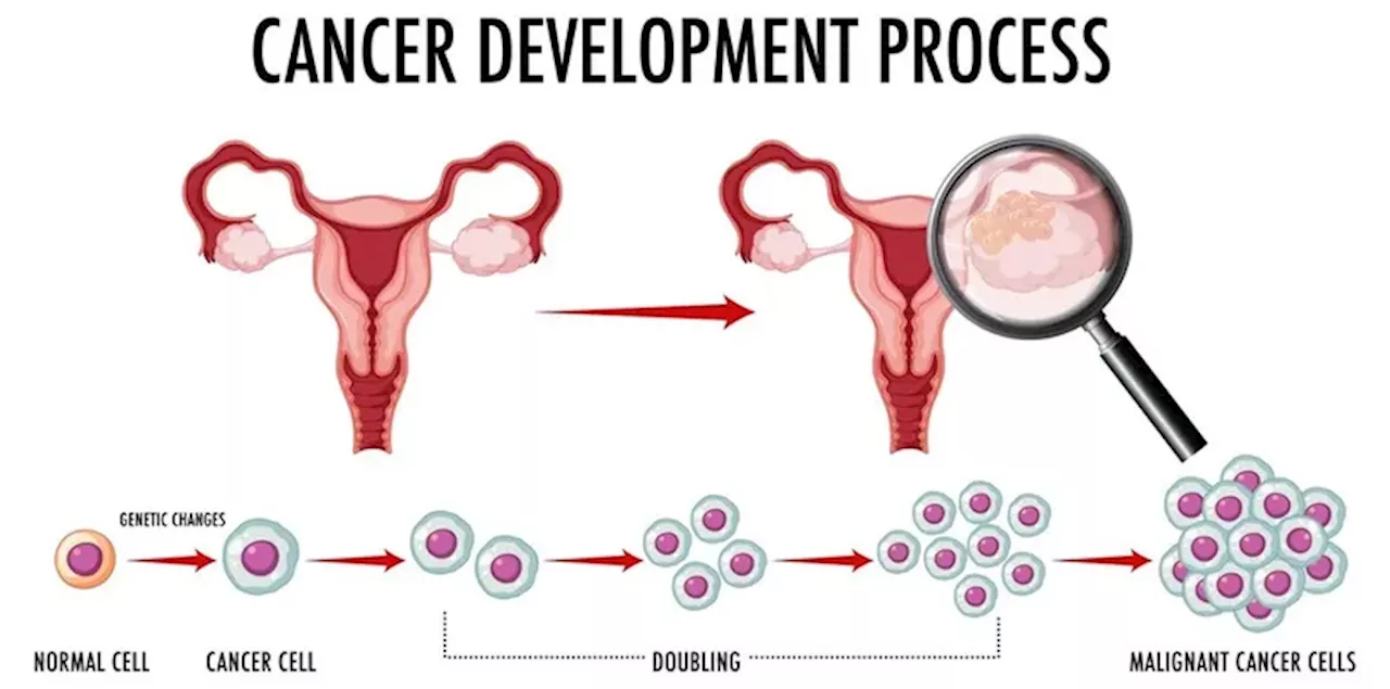 Pentingnya Pemeriksaan Pap Smear dalam Mencegah Kanker Serviks