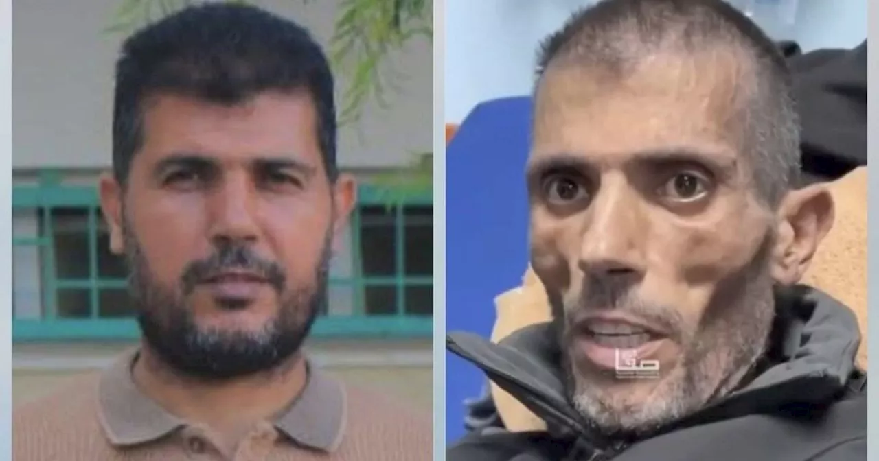 Released Gazan Teacher Describes 'Indescribable' Torture in Israeli Jail