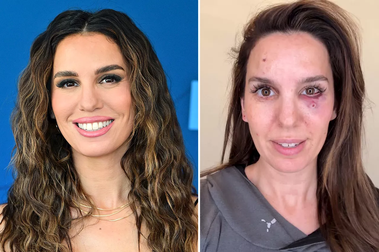 Christy Carlson Romano Nearly Lost Eye in Clay Pigeon Shooting Accident