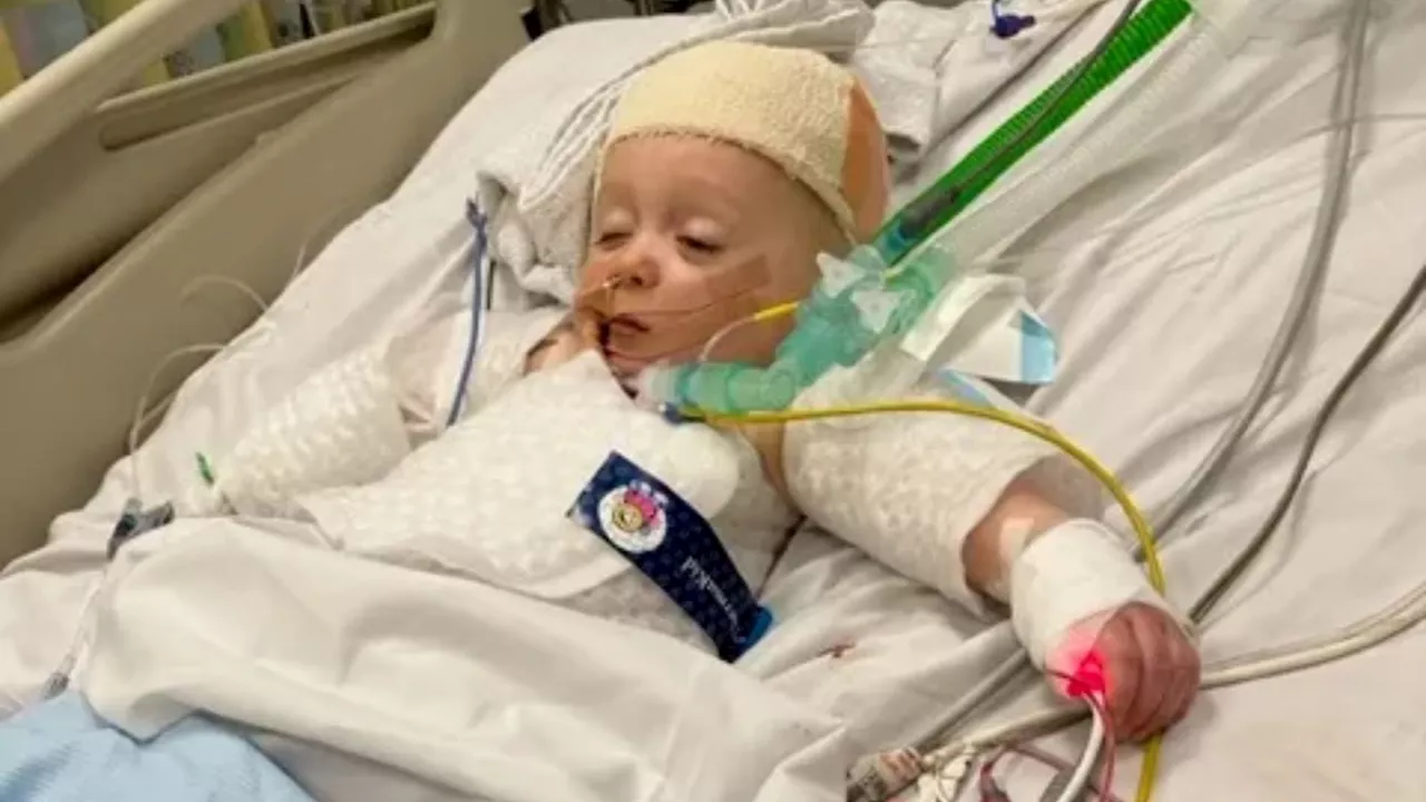 From Playground to Life-Saving Surgery: Toddler's Terrifying Head Injury