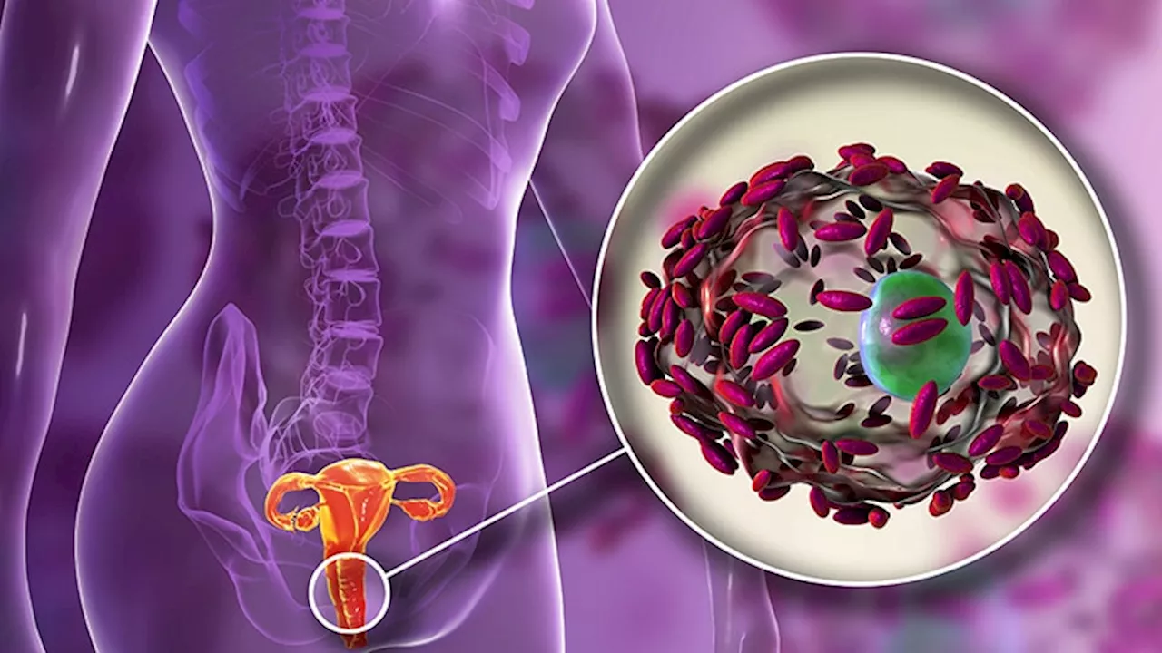 Study Reveals Sexual Transmission of Bacterial Vaginosis
