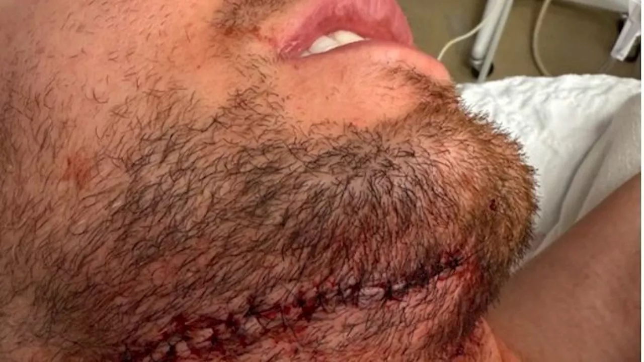 Devils GM Tom Fitzgerald recounts son's nightmare hockey injury
