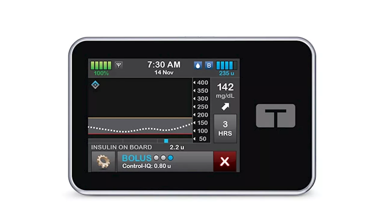 Automated Insulin Delivery System Helps in Type 2 Diabetes
