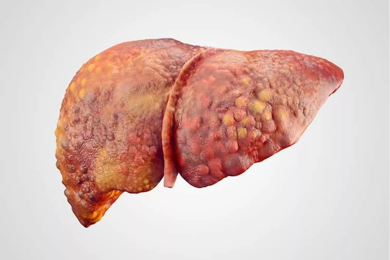 PT Health Watch: How Nigerians can prevent liver, kidney disease