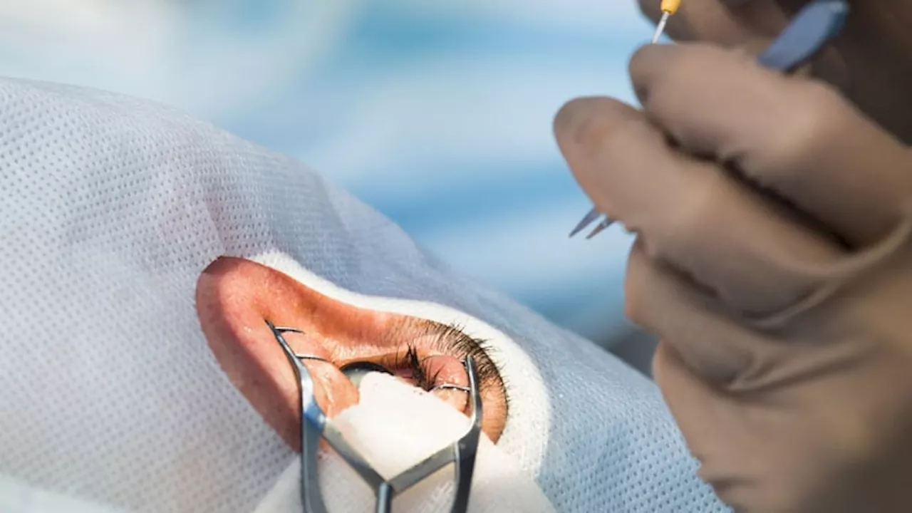 Multiple Drug Classes Can Up Risk for Floppy Iris Syndrome