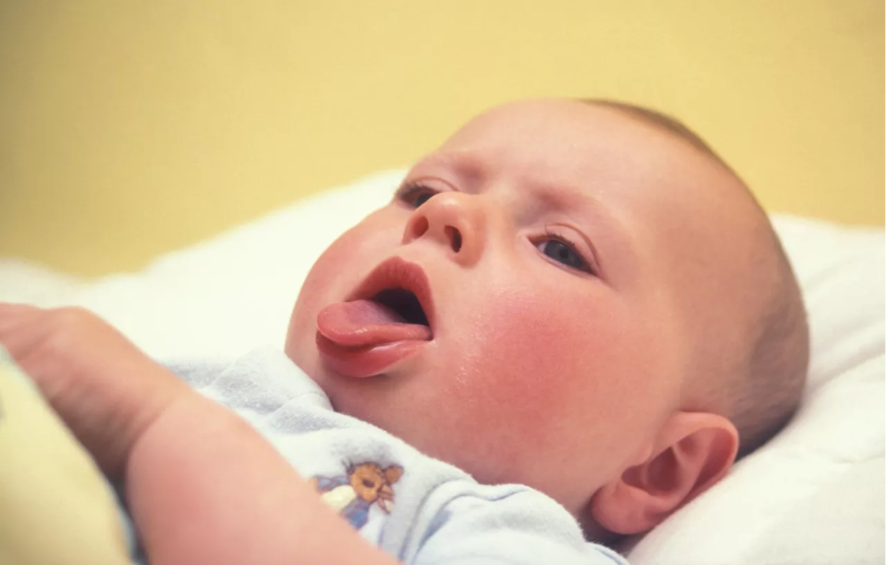 Record number of Irish whooping cough cases reported in 2024