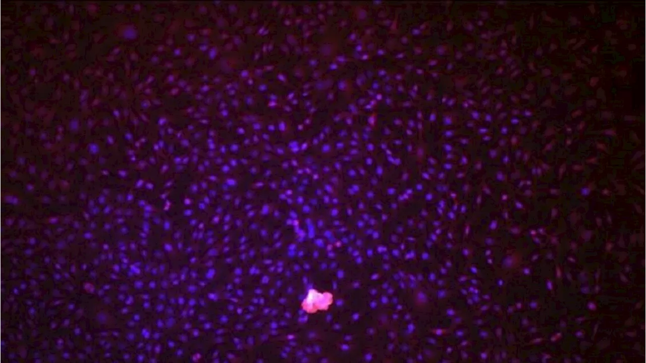 Dalle cellule staminali vasi sanguigni per i bypass