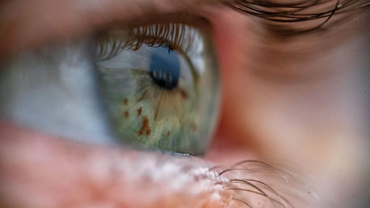 New cells discovered in eye could help restore vision, scientists say