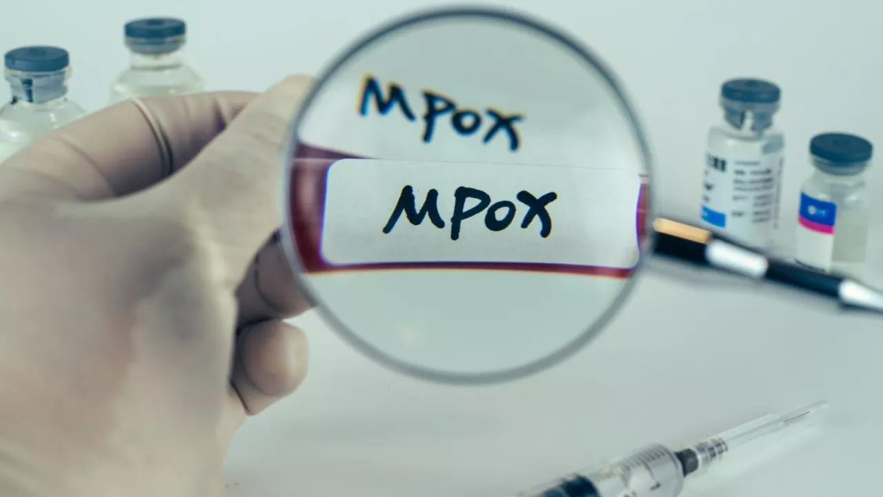 Three new Mpox cases reported in South Africa – Health Department