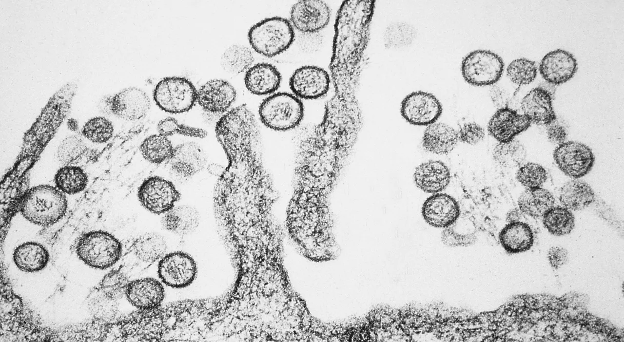 Hantavirus, cos'è il virus (trasmesso dai topi) che ha ucciso la moglie di Gene Hackman Betsy Arakawa: cause,
