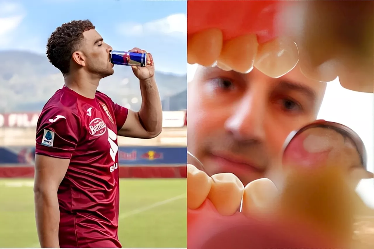 Fizzy drinks may cause tooth decay in young footballers: UK study