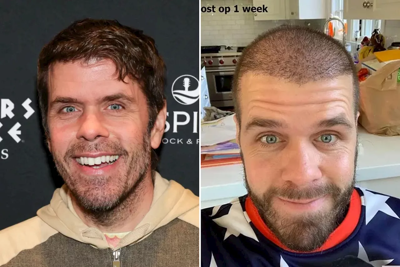  Perez Hilton shares truth about his multiple hair transplants: 'I'm going to spill all the tea'