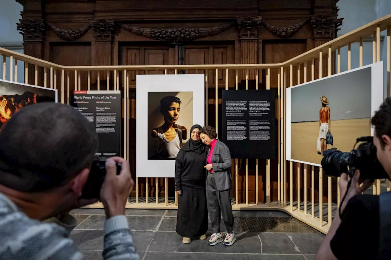 ‘How will I hug you?’ Haunting portrait of young Palestinian amputee wins World Press Photo top honour