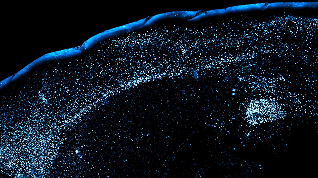 Mouse brains hint at why it’s so hard to forget food poisoning