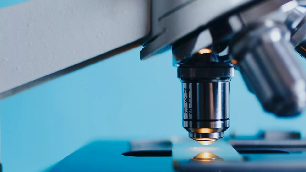 Scoperta la possibile causa del boom dei casi di cancro al colon tra gli under 50