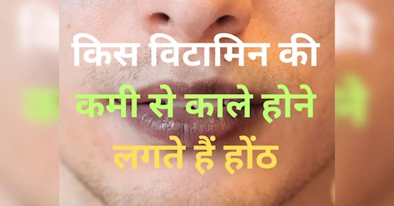 Trending Quiz: किस विटामिन की कमी से काले होने लगते हैं होंठ, जानें बचाव?