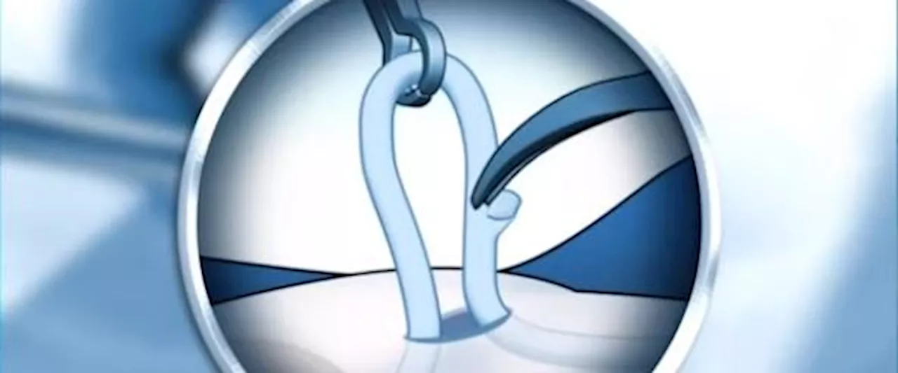 Vasectomy: Does the snip affect arousal, can it be reversed, and more questions answered
