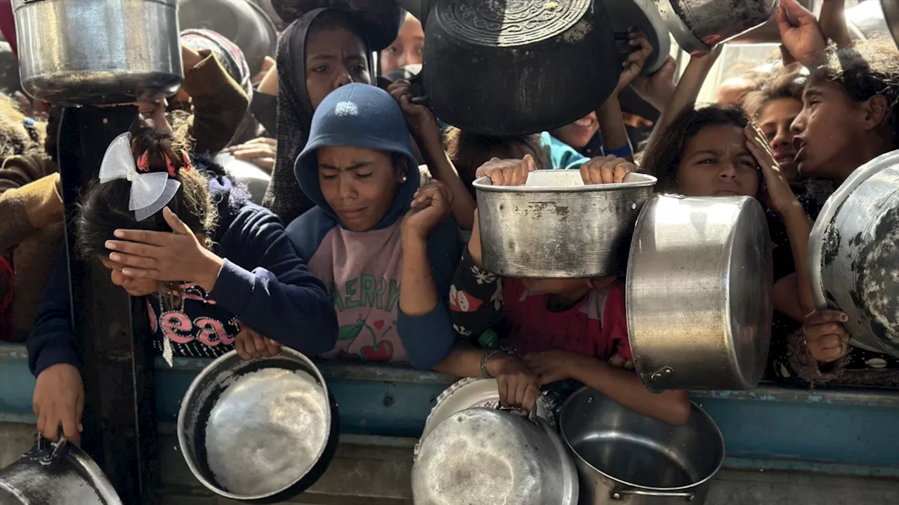 El día a día del horror en Gaza: '¿Cómo le explicas a un cirujano que ampute a un niño sin anestesia?'