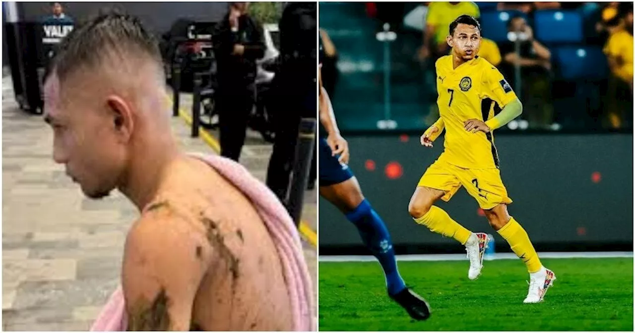 – Faisal Halim Expresses Sadness Over 'No Further Action' Verdict in Acid Attack Case