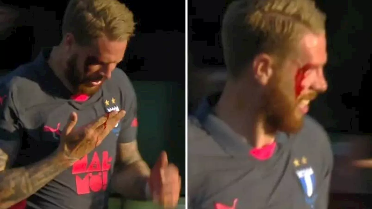 Pontus Jansson knockas blodig – efter målet