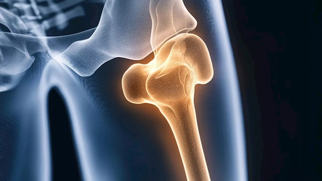 Fracture Risk Lower With Semaglutide vs Sleeve