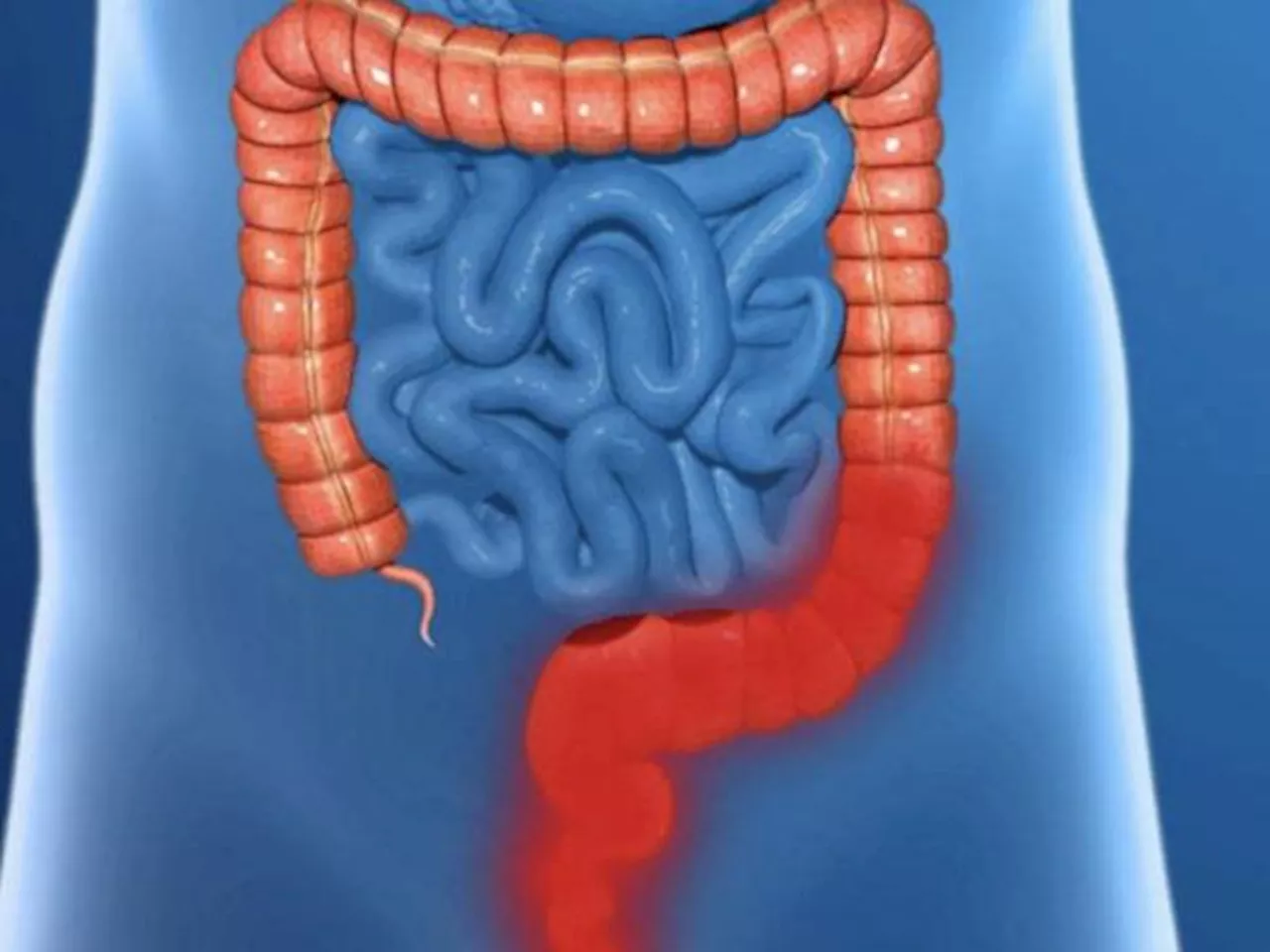 Hágalo en su casa: 4 maneras de limpiar el colon de manera natural