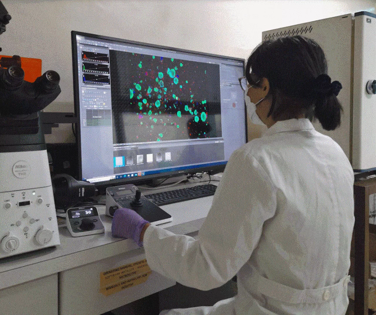 UP biologists use mathematical model to detect early signs of metastasis in breast cancer patients