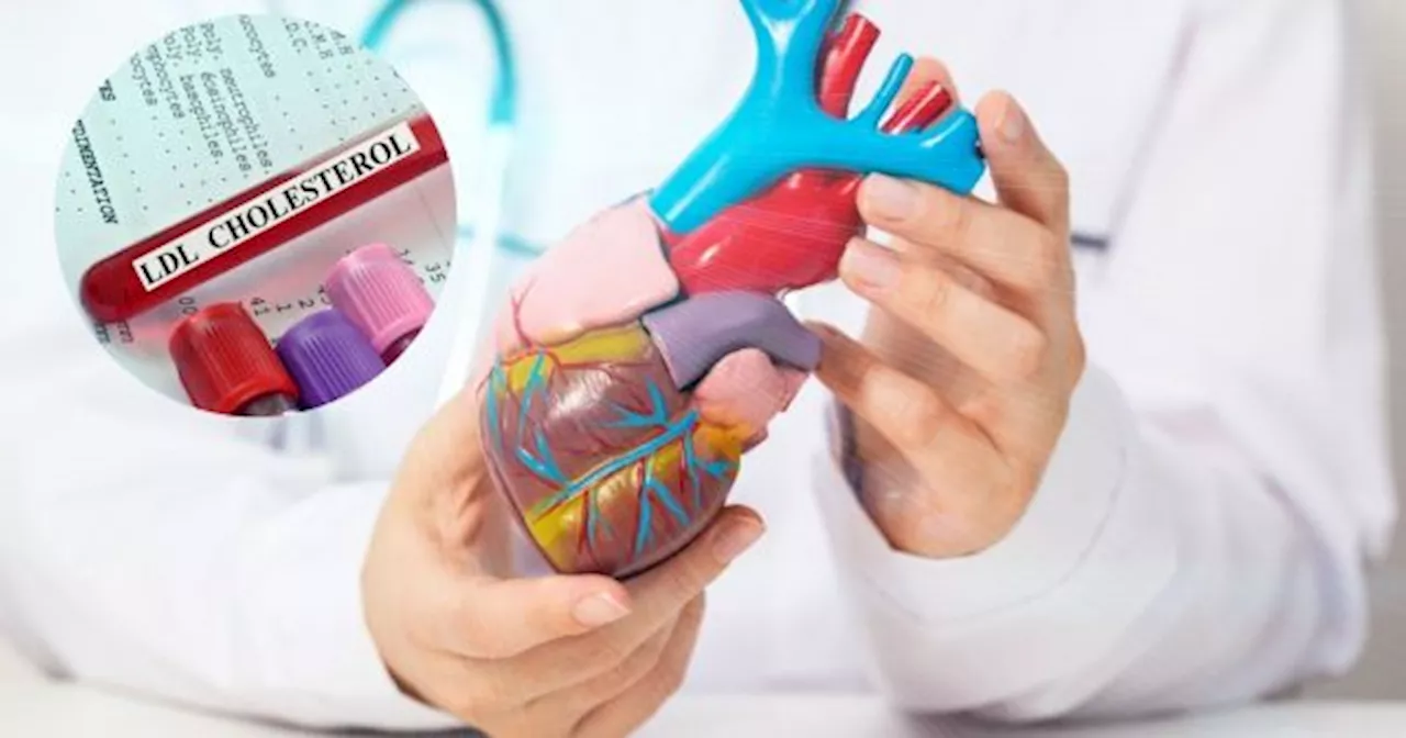 CHAU COLESTEROL: el hábito que hay que dejar antes de los 50 años para ayudar al corazón