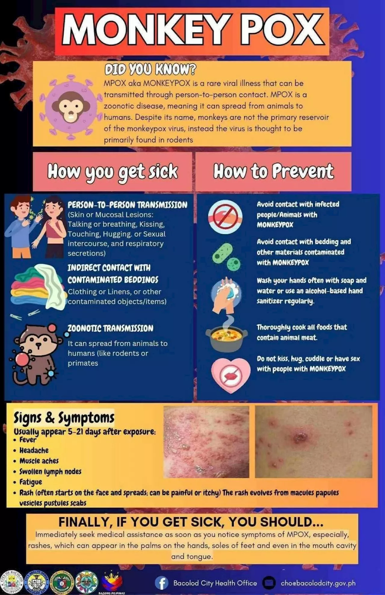 Bacolod health official urges people to report suspected monkeypox cases