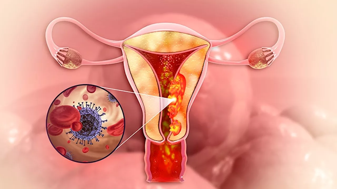 Cut the Clutter in Gynaecological Cancer Diagnosis