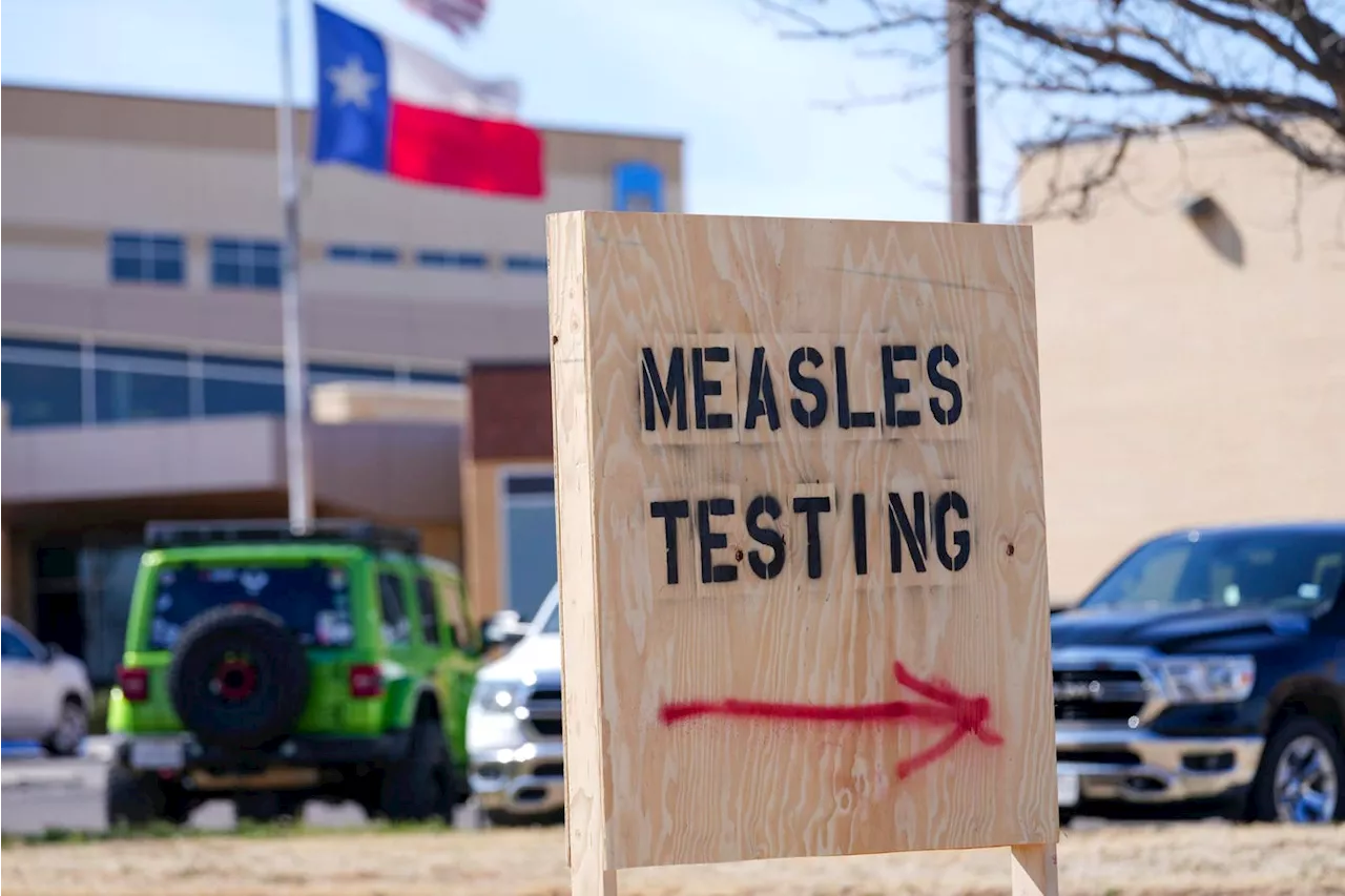 Measles Updates: More Than 930 Cases As Texas Outbreak Spreads