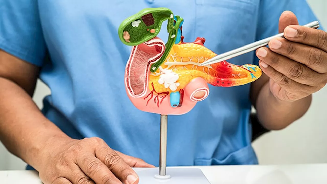 Deep Learning–Based Model Aids Diagnosis of Chronic Pancreatitis