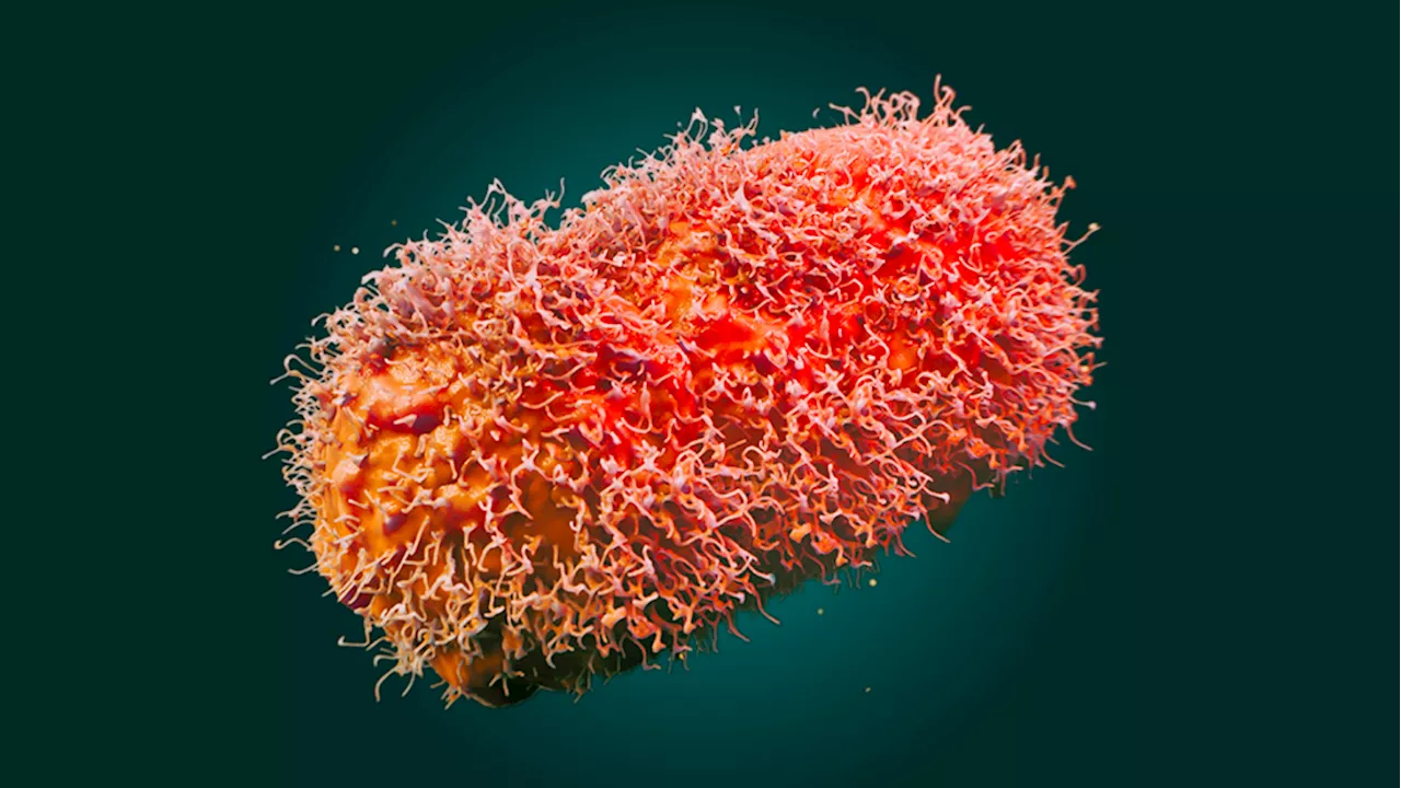 Aklan on high alert against Mpox entry