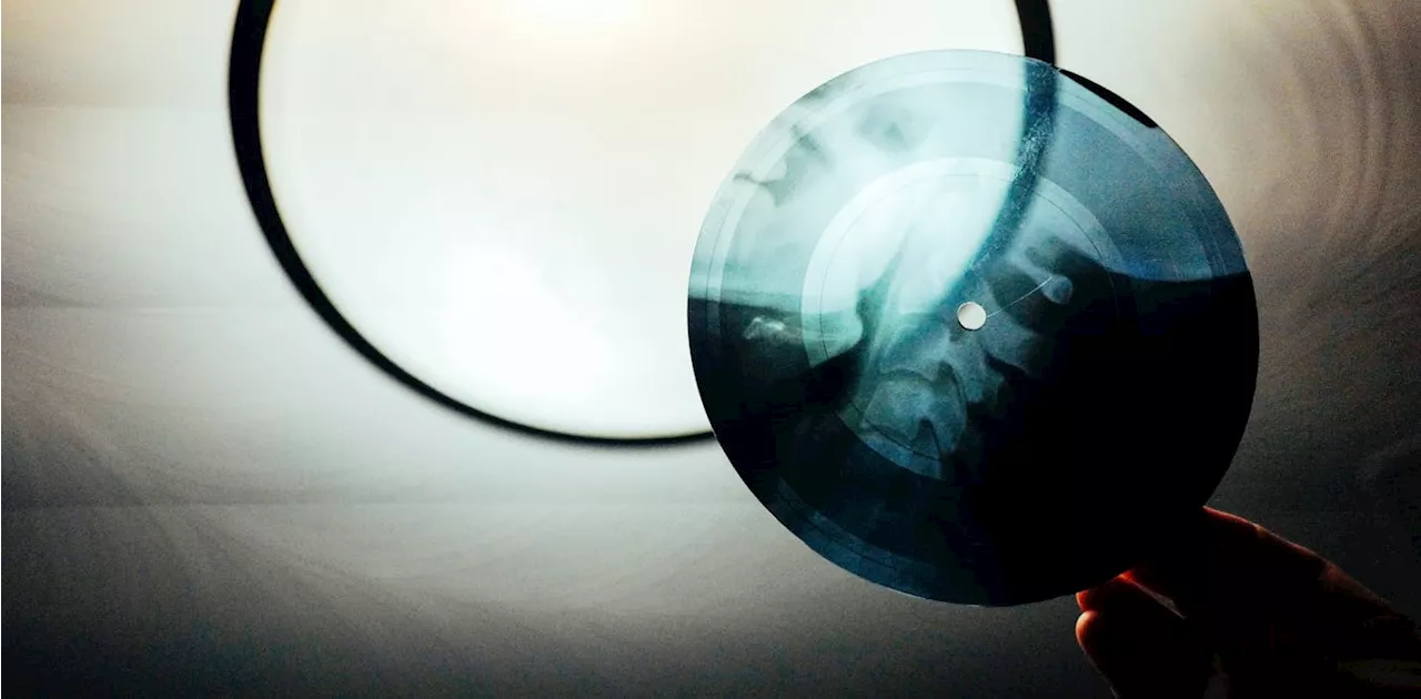 When Elvis and Ella were pressed onto X-rays – the subversive legacy of Soviet ‘bone music’