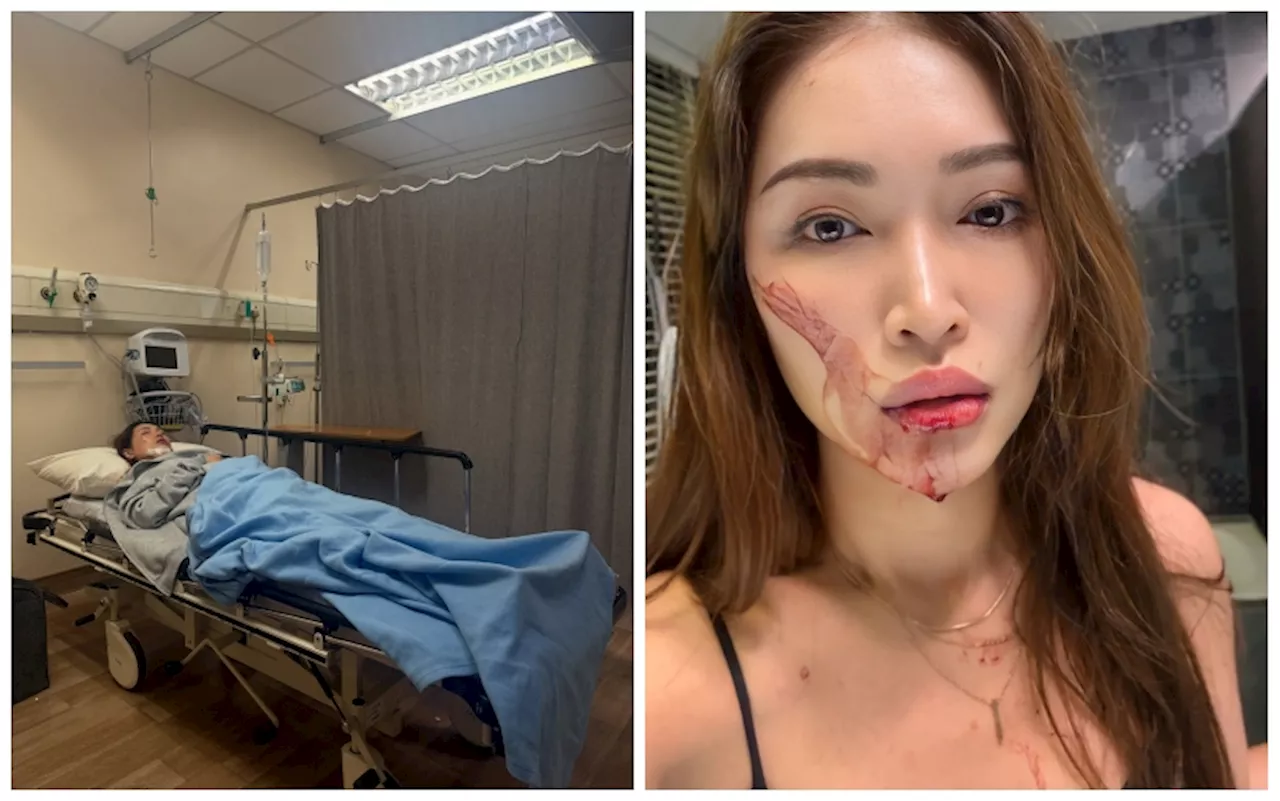 Amber Chia hospitalised after collapsing from exhaustion