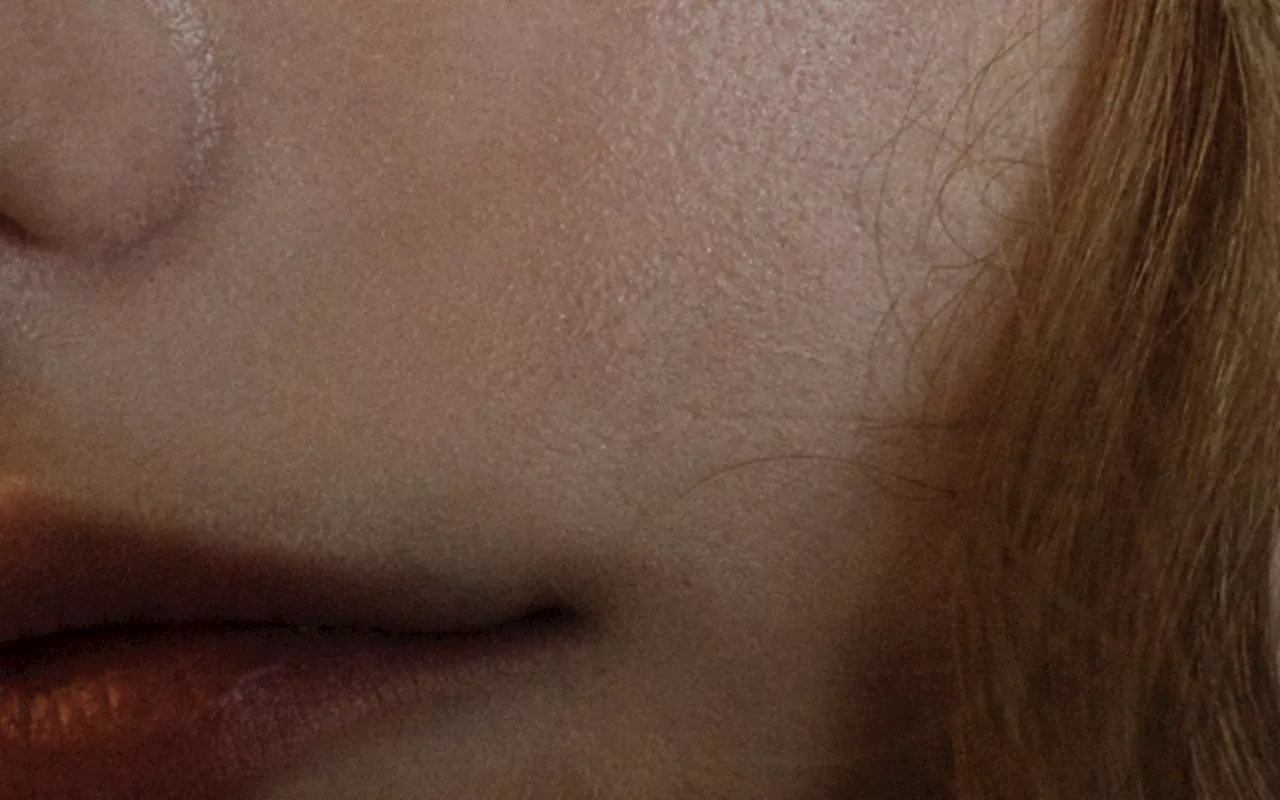 What Is Dermorexia, & How Do You Know If You Have It?