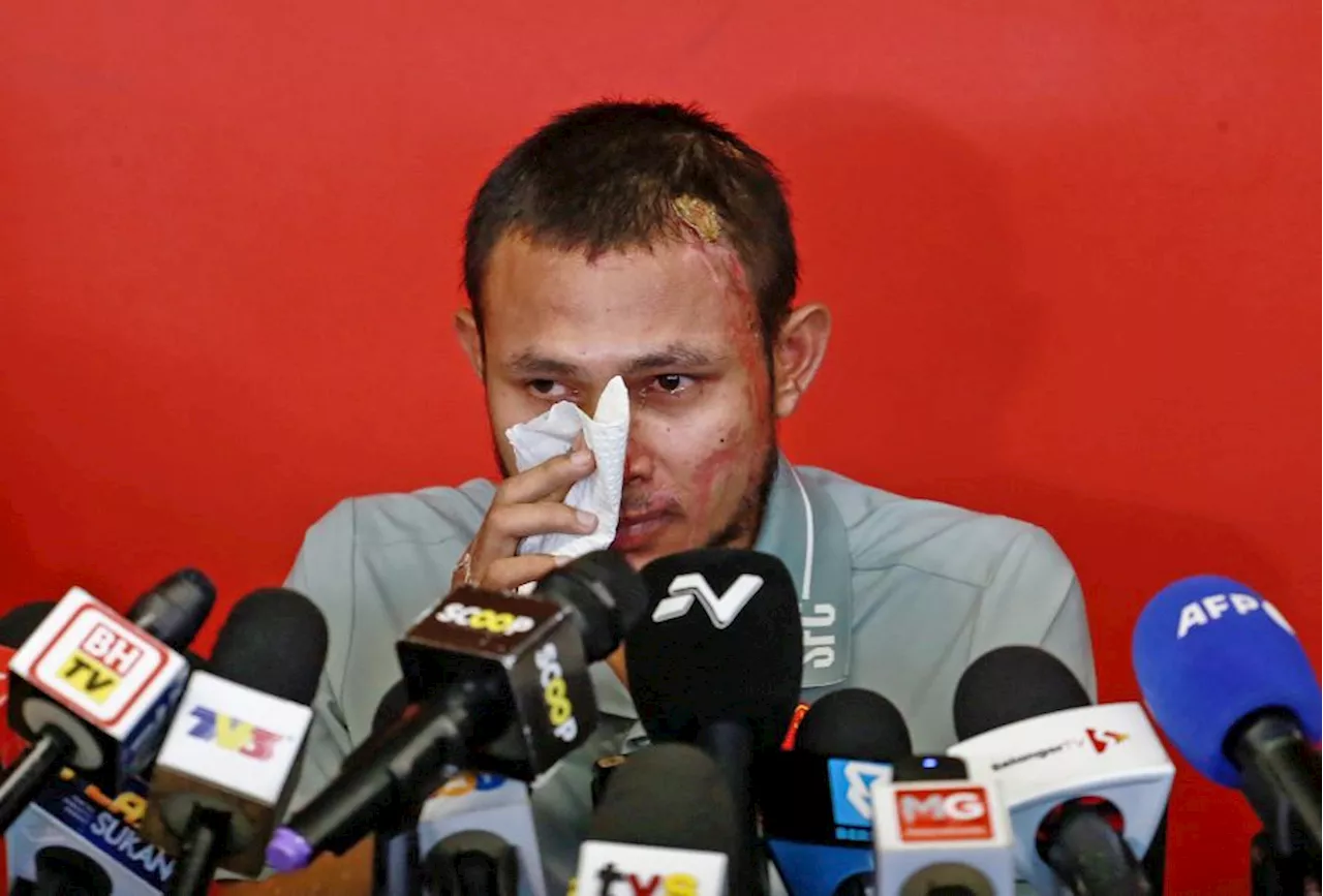 Faisal Halim imbas detik ‘perit’ disimbah asid