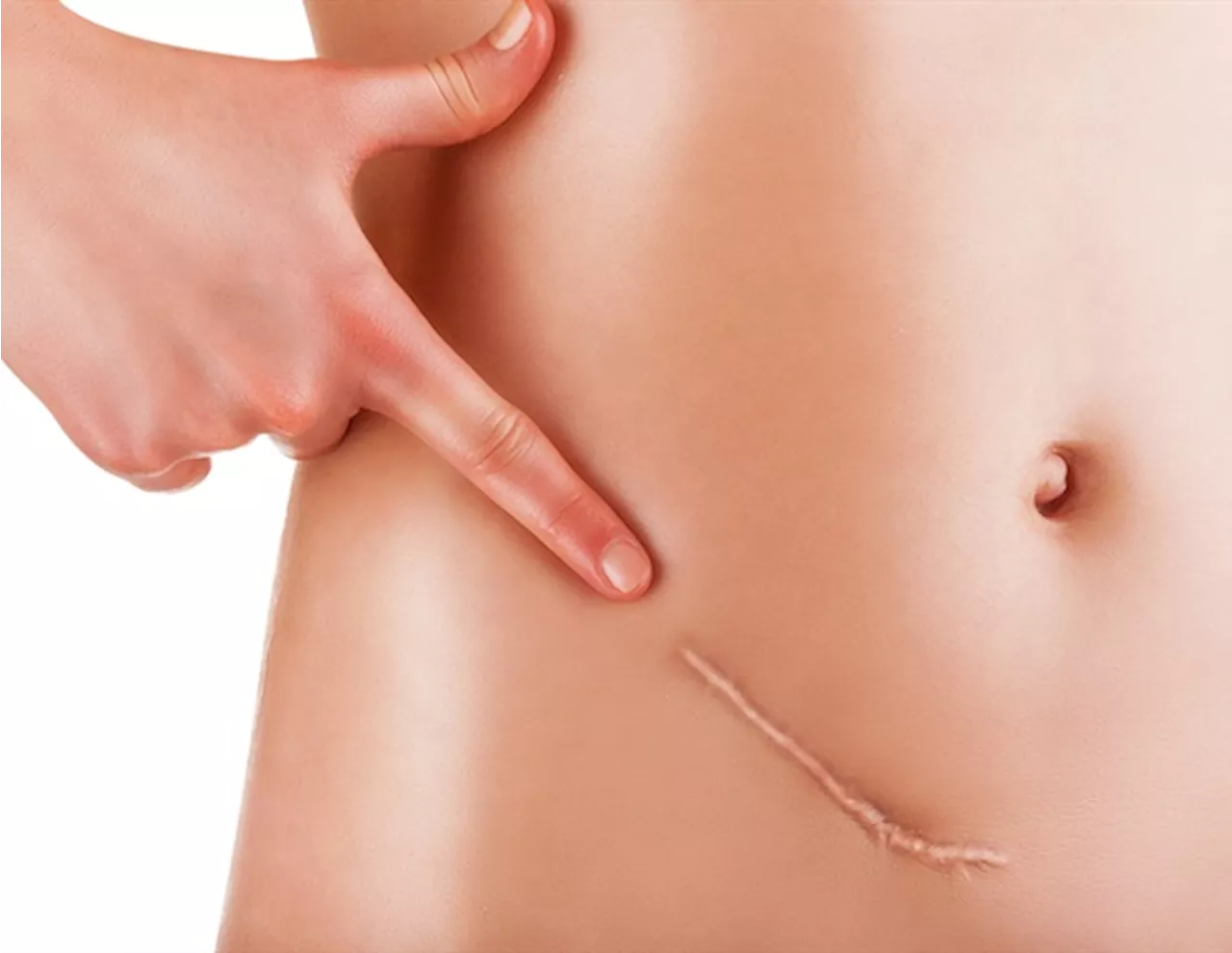 Study reveals the genetic underpinnings of a rare and aggressive ovarian cancer