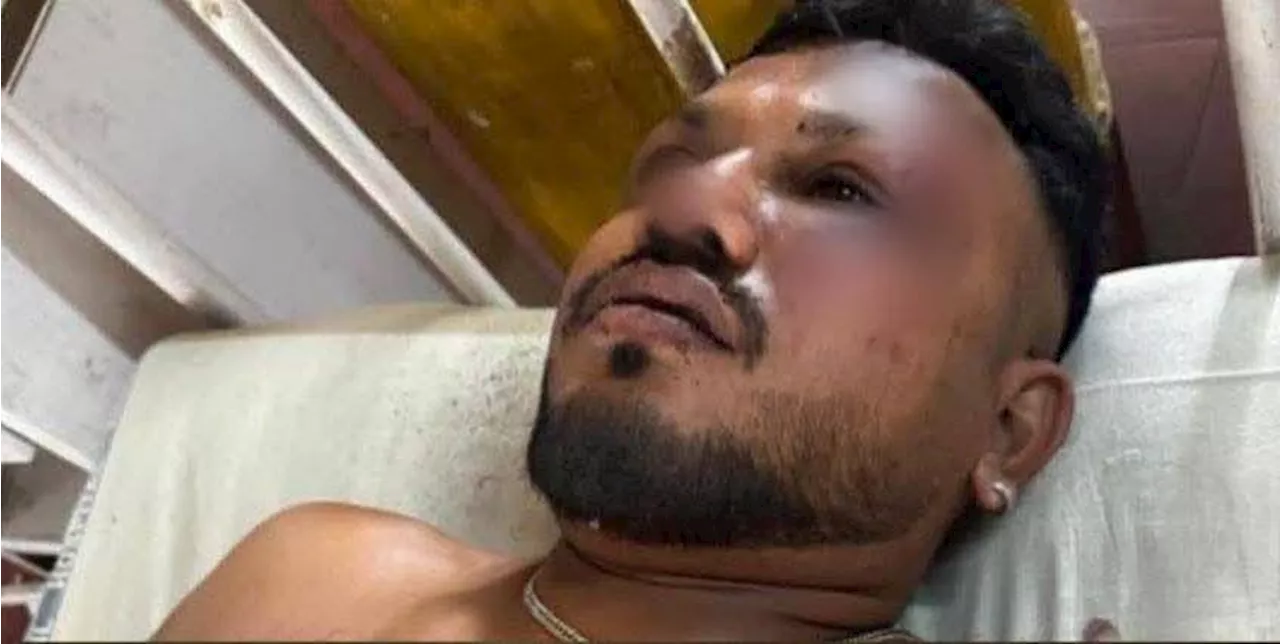 'I don't know how I survived' -- sole survivor of fatal Air India crash recounts escape
