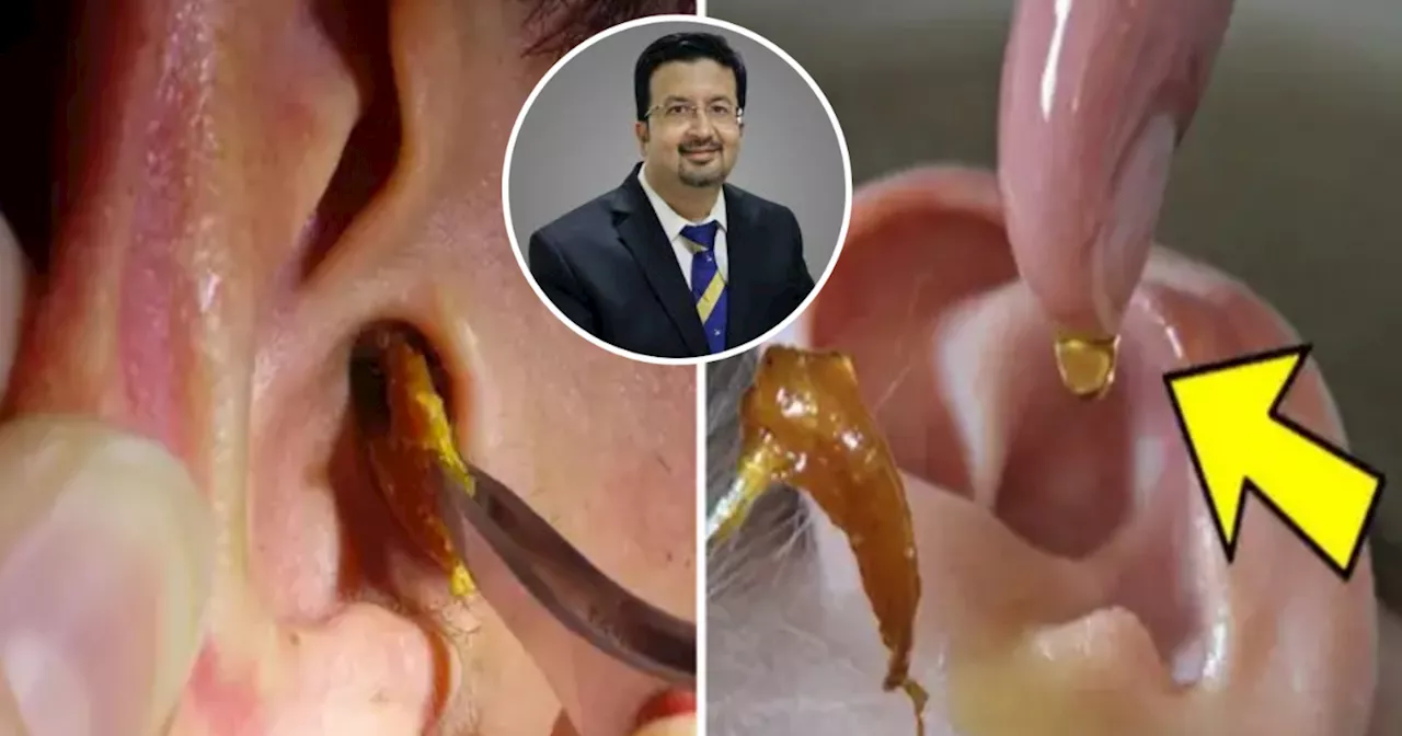 How To Remove Earwax: अपोलो डॉ. ने बताए कान का मैल निकालने के 3 तरीके, पिघलकर बाहर आएगा पीला कचरा
