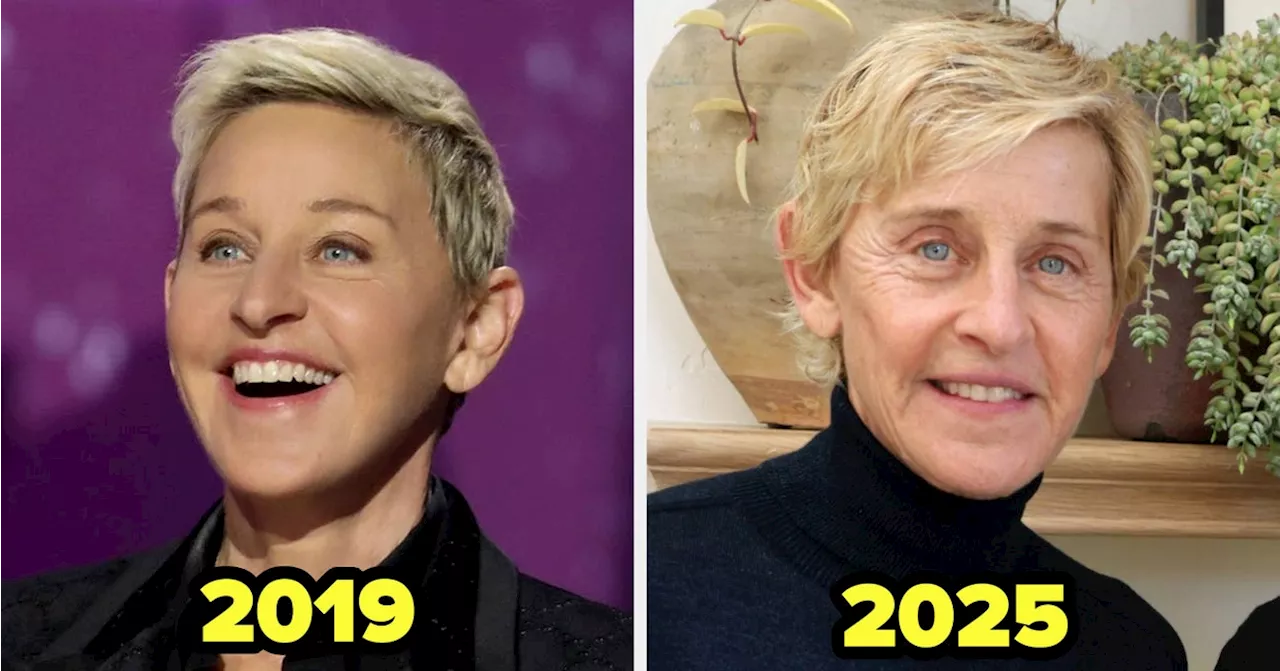 The Fillers Backlash: Celebrities and the Growing Trend of Dissolving Cosmetic Enhancements