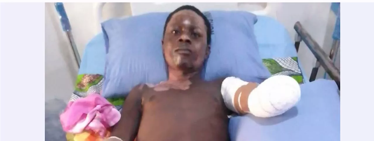 Taraba Poly student loses both hands after electrocution while hoisting PDP flag
