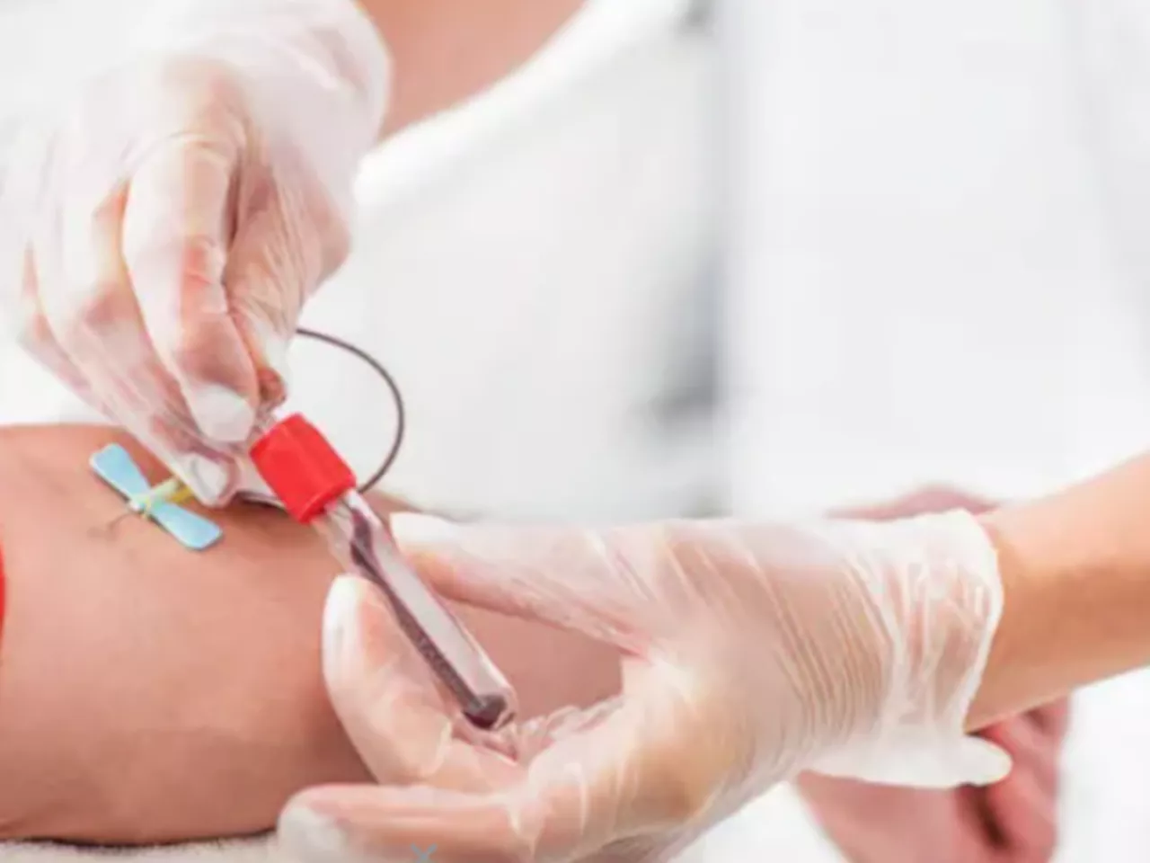 Los costosos y polémicos tratamientos para limpiar la sangre de microplásticos