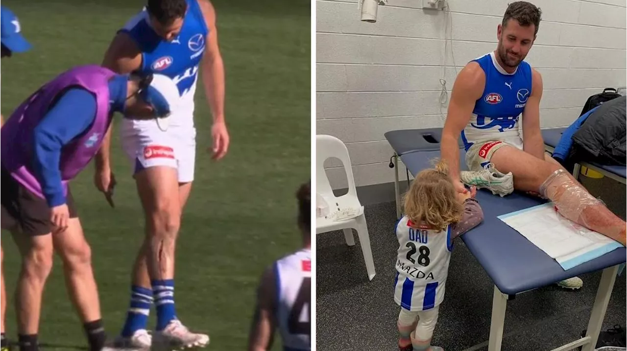 Growing ‘concern’ around AFL players’ boots in wake of gruesome injury to Jack Darling